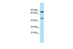 SMAP2 Rabbit anti-Human, Polyclonal, Novus Biologicals 0.1 mL | Buy Online | Novus Biologicals | Fisher Scientific